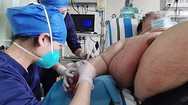 berat badan naik drastis selama lockdown