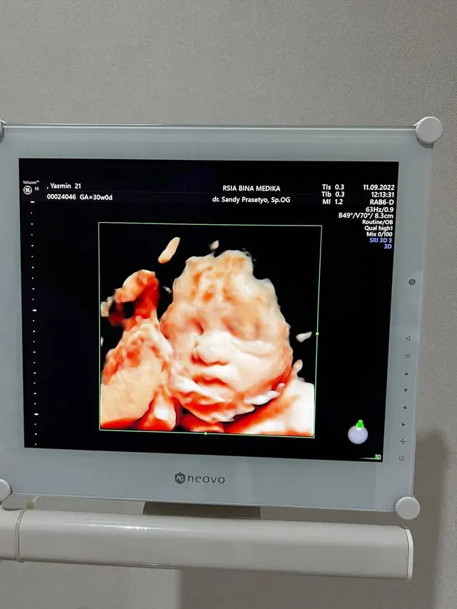 Yasmine Ow sebut janin yang dikandungnya mirip Aditya Zoni