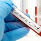 ilustrasi virus corona covid-19/photo copyright by Shutterstock