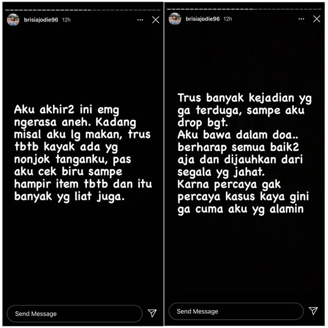 Curhat Brisia Jodie Alami Kejadian Mistis Hingga Luka Lebam, Diduga Kena Santet