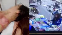 Porsinya Kurang, Pembeli Tega Siram Penjual dengan Sup Panas