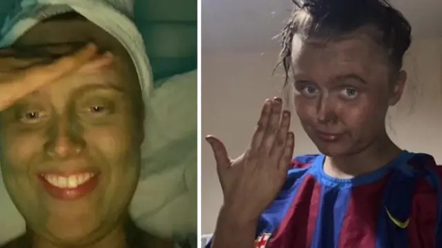 Niat Bikin Tanning, Kulit Wanita Ini Berubah Hijau Bak Sherk