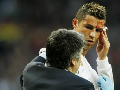 Striker Real Madrid, Cristiano Ronaldo, mengalami pendarahan di bagian pelipis saat melawan Deportivo La Coruna pada laga La Liga di Stadion Santiago Bernabeu, Minggu (21/1/2018). Real Madrid menang 7-1 atas Deportivo La Coruna. (AP/Francisco Seco)
