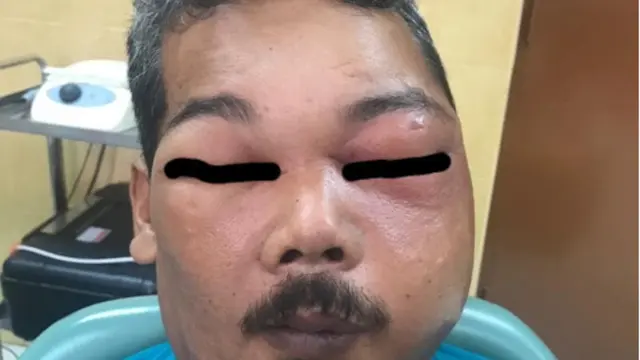 Pakai Minyak Rem Obati Gigi yang Sakit, Ini yang Terjadi