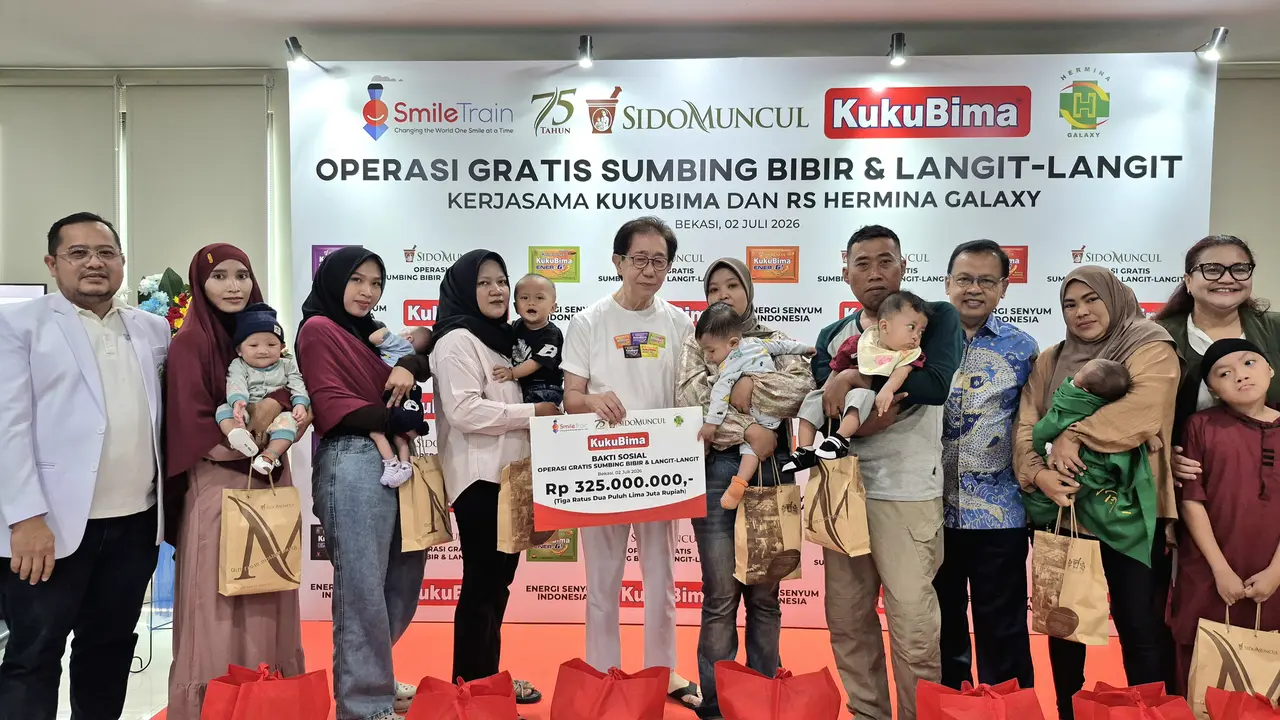 Sido Muncul Salurkan Bantuan Rp325 Juta untuk Operasi Gratis Sumbing Bibir di RS Hermina Galaxy