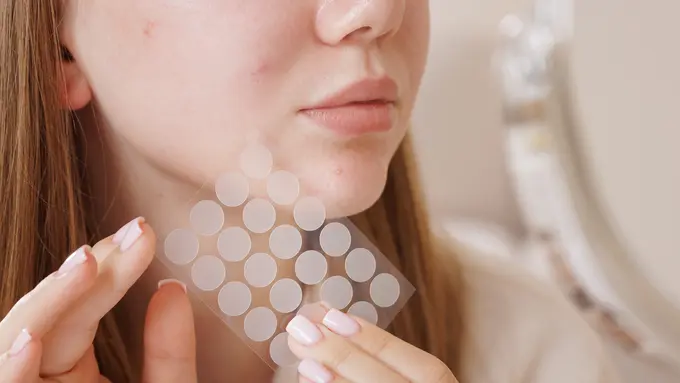 Jangan Asal Tempel! Ini Cara Pakai Acne Patch Biar Hasilnya Maksimal