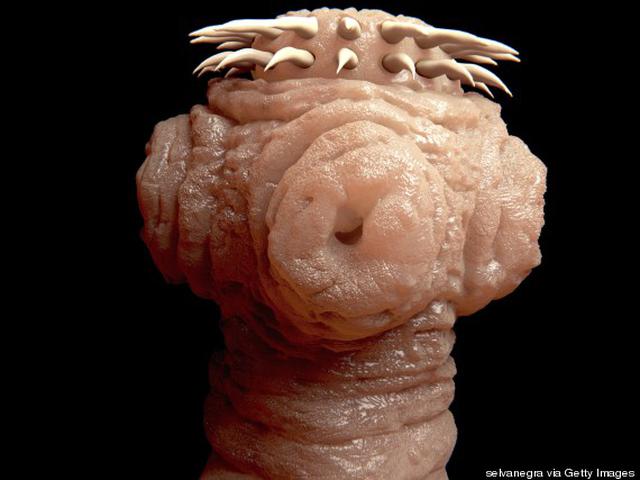 Selalu Sakit Kepala Ternyata Di Otak Ada Sarang Cacing Pita Citizen6 Liputan6 Com