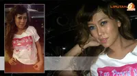 Natha Narita Cari Pacar untuk Temani Operasi Besarkan Pinggul