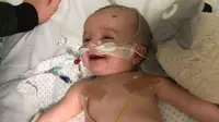 Michael, seorang bayi yang menderita tumor langka mengalami koma selama lima hari namun kemudian langsung tersenyum saat bangun dan melihat ayahnya. (Source: Emma Labuschagnes)
