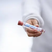 Ilustrasi coronavirus, virus corona, koronavirus, Covid-19. Kredit: Fernando Zhiminaicela via Pixabay