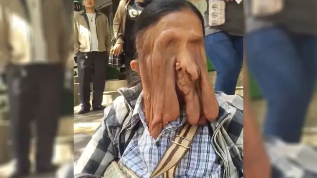 Wajahnya Mencair, Ini Alasan Nenek 63 Tahun Tolak Bantuan Medis