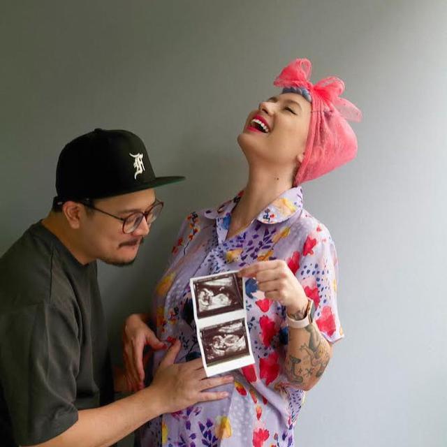 6 Potret Derby Romero Jadi Suami Siaga, Siap Sambut Kelahiran Anak Perempuan