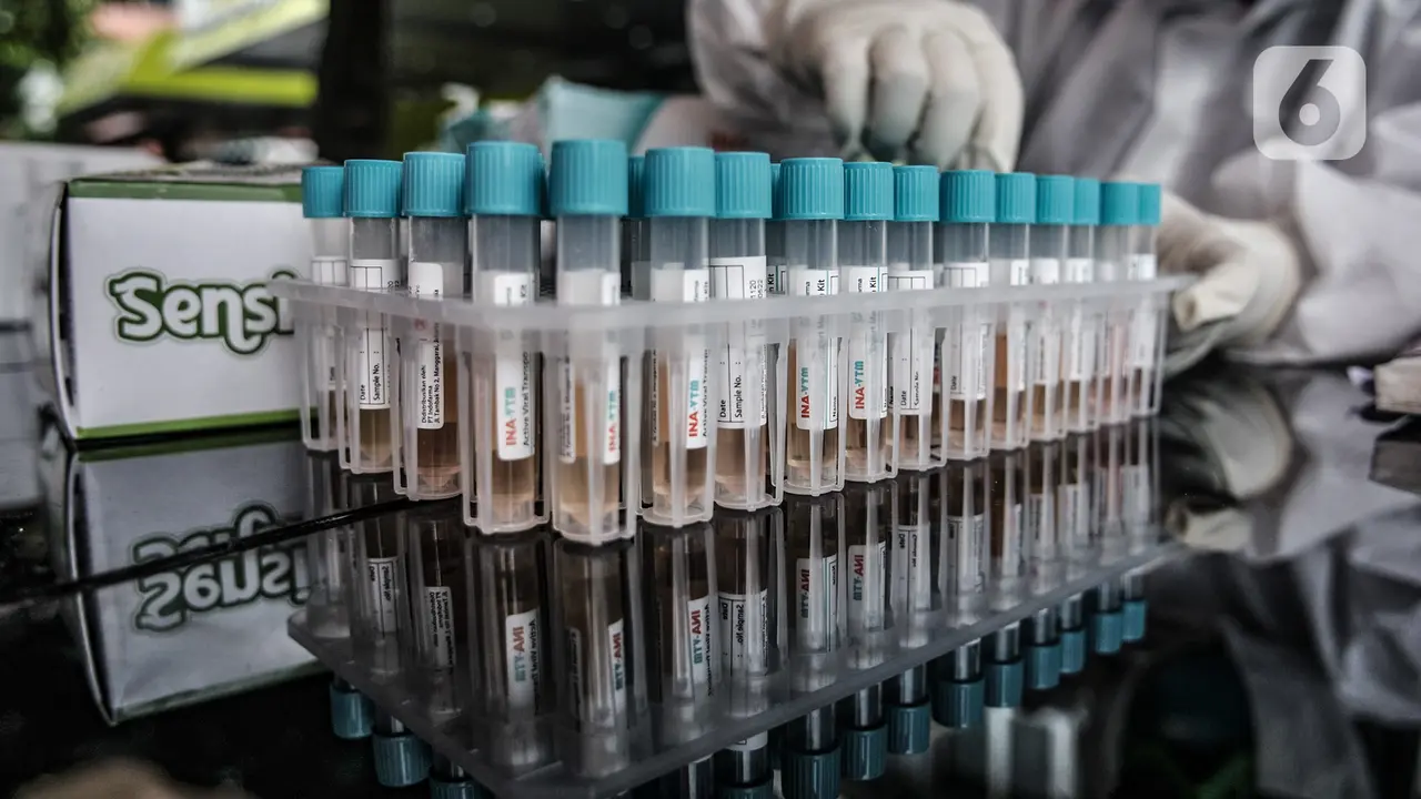 Lacak Penyebaran Covid-19 dengan Tes Swab PCR Drive Thru