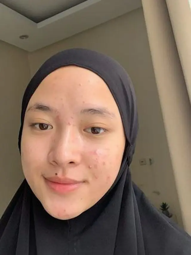 Unggah Foto Berjerawat, Ini 6 Potret Nissa Sabyan Tanpa Makeup