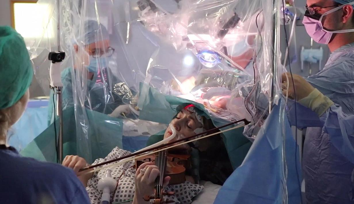 Operasi Pengangkatan Tumor Otak