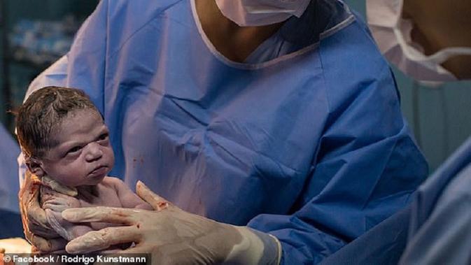 Seorang bayi asal Brasil tampilkan wajah cemberut saat lahir ke dunia. Facebook/ Rodrigo Kunstmann