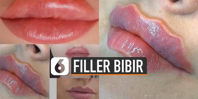 VIDEO: Ikut Tren Filler Bibir Keriting Bisa Diakali Dengan Cara ini