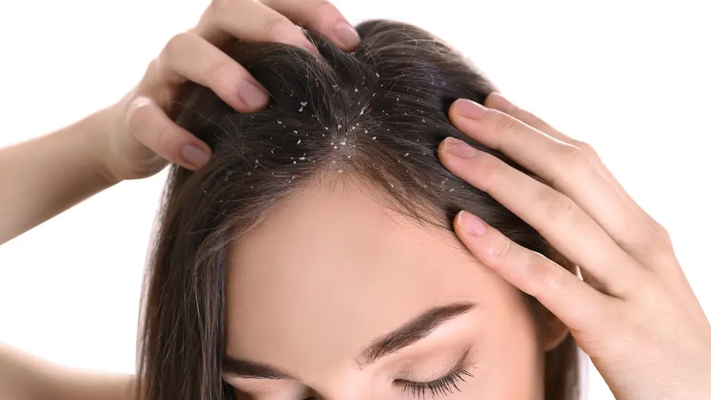 Ilustrasi Ketombe/https://www.shutterstock.com/New Africa