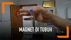 Seorang bocah 13 tahun menjalani operasi karena memasukkan 29 bola magnet ke alat kelaminnya. Bermula dari rasa penasaran, anak ini bereksperimen hingga akhirnya ia sulit buang air kecil.