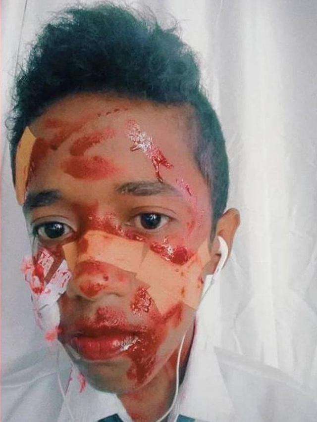 Potret Nyeleneh Pura-Pura Sakit Ini Bikin Ketawa Sekaligus Emosi