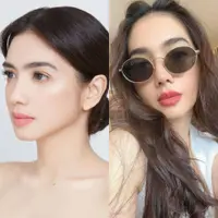 Lihat di sini beberapa potret penampilan terbaru Angel Karamoy setelah operasi plastik.