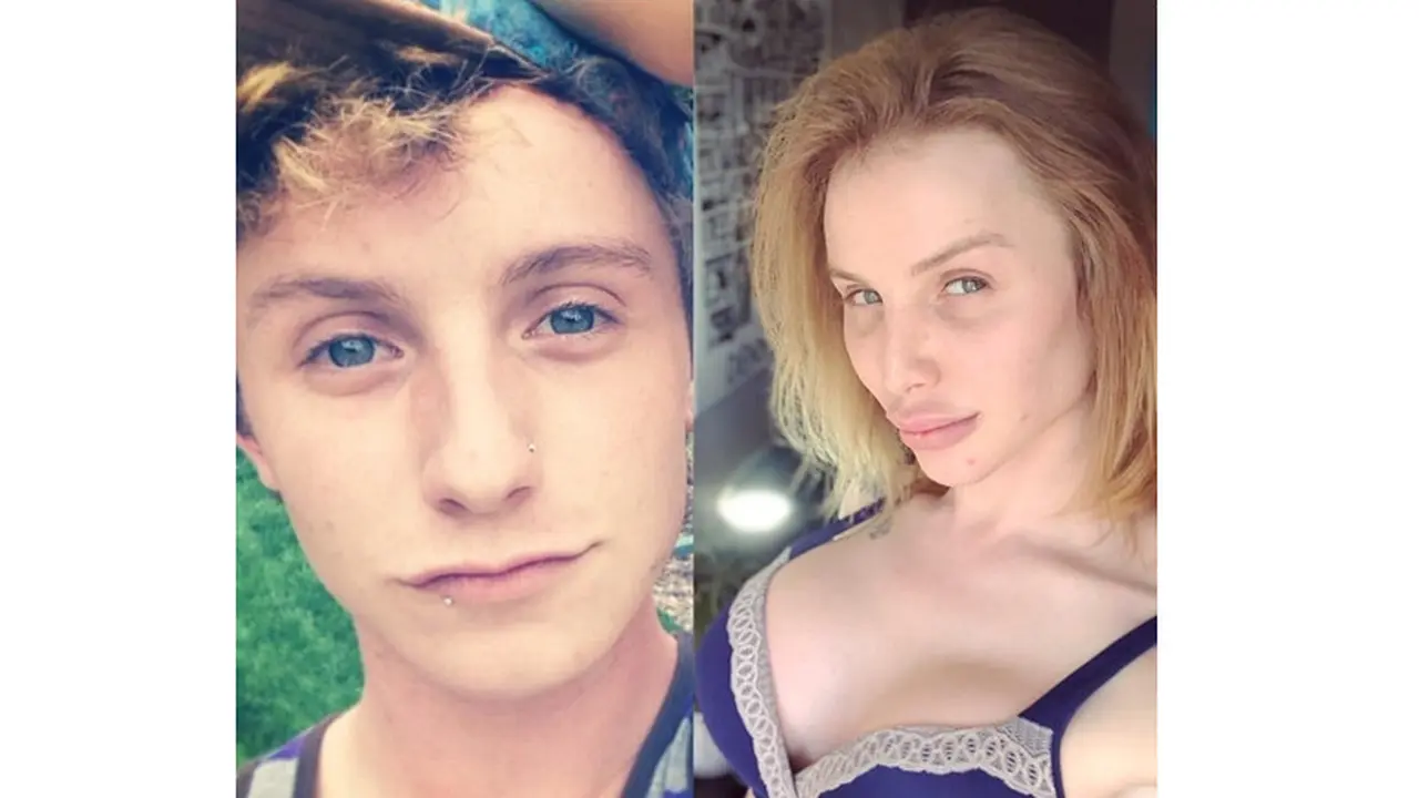 Kyleigh Potts, transgender habiskan Rp 1 M demi mirip Kylie Jenner