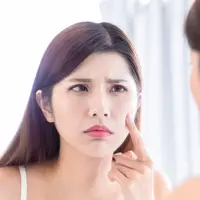 Seorang wanita cantik mengalami masalah jerawat. (depositphotos.com/ryanking999)