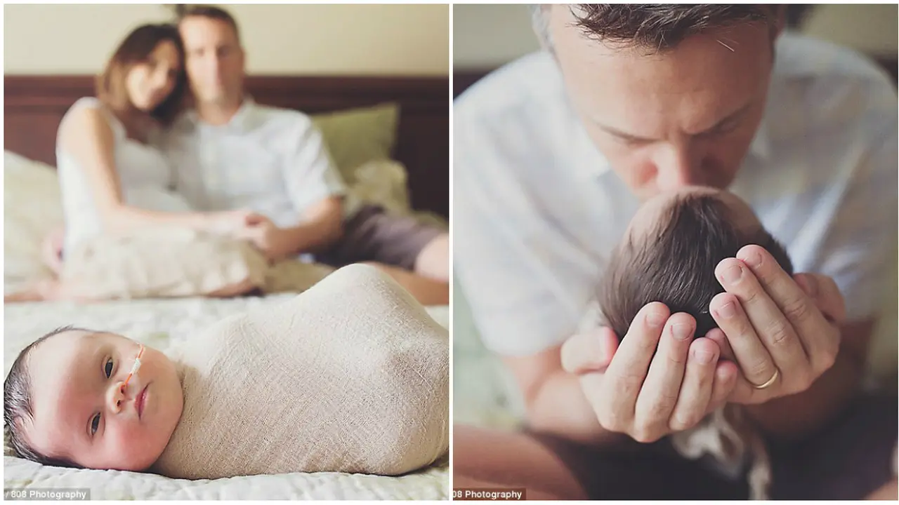 Kisah Haru di Balik Lahirnya Bayi Cantik Down Syndrome