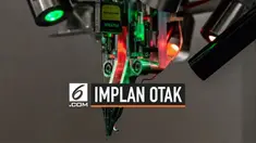 Perusahaan Neuralink milik Elon Musk, menciptakan chip yang bisa dihubungkan ke otak manusia.