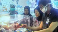 Bayi kembar siam asal Subang ini hanya memiliki satu anus dan alat kelamin. (Liputan6.com/Arie Nugraha)
