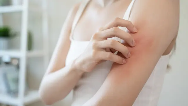 Apakah Perawatan Wajah Boleh Dilakukan oleh Penderita Eksim? Kenali Dulu Kondisi Kulitmu, Yuk!