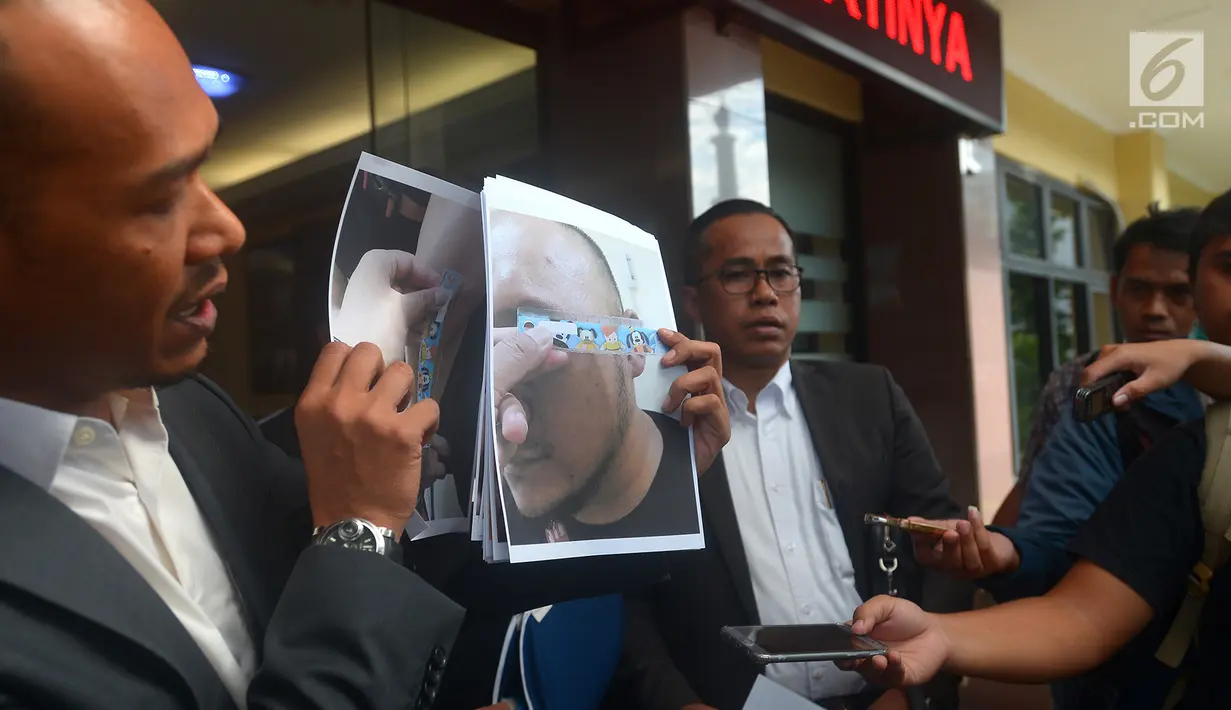 Kuasa hukum Ronny Yuniarto, Febby Sagita menunjukkan gambar usai membuat laporan di Polres Metro Jakarta Selatan, Kamis (21/6). Dugaan sementara, penganiayaan terjadi akibat masalah lalu lintas. (Merdeka.com/Imam Buhori)