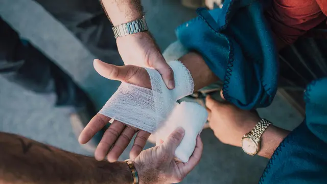 Cara Menghilangkan Bekas Luka Bakar Tanpa Ribet