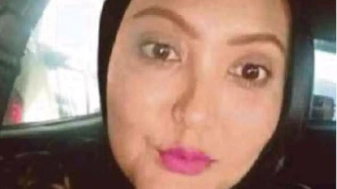 [Bintang] Ketagihan Suntik Kolagen, Hal Mengerikan Terjadi Pada Wanita Ini