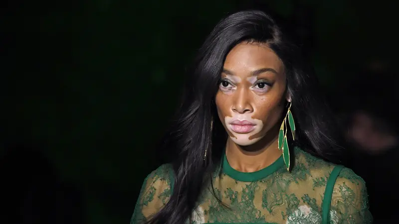 Winnie Harlow di Panggung Paris Fashion Week