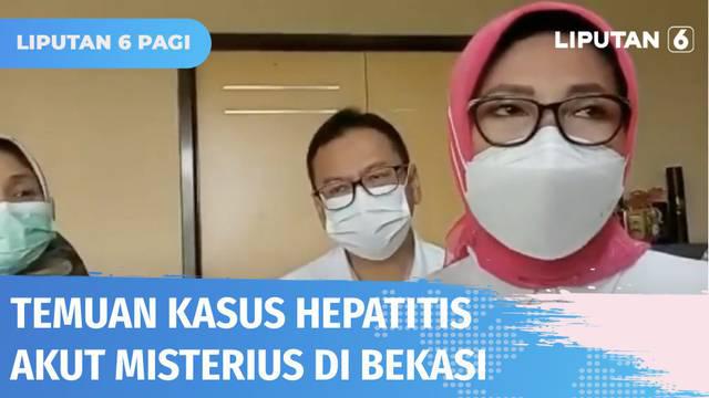 Pemerintah Kota Bekasi menginformasikan, seorang anak berusia 10 tahun diduga terjangkit penyakit hepatitis akut misterius. Sejauh ini Kemenkes mencatat ada 15 kasus hepatitis akut di Indonesia yang tersebar di lima provinsi.