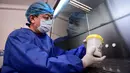 Petugas laboratorium melakukan pengujian sampel dari orang yang akan diuji untuk virus corona COVID-19 di sebuah laboratorium di Shenyang, provinsi Liaoning timur laut China, Rabu (12/2/2020). Pemimpin WHO di Jenewa mengganti nama virus corona Wuhan menjadi Covid-19. (STR/AFP)