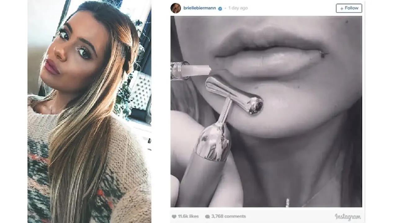 Kim Zolciak-Biermann melakukan operasi bibir yang serupa dengan Kylie Jenner
