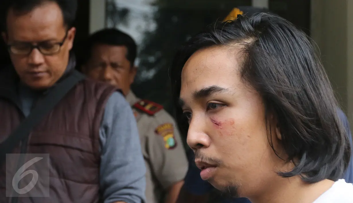 Korban pemukulan, Kevin yang merupakan mahasiswa saat berada di polsek Jagakarsa, Jakarta, Kamis (18/02/2016). Kevin mengalami cidera disekitar matanya . .(Liputan6.com/Herman Zakharia)