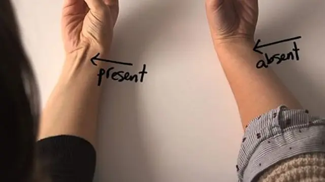 otot panjang di tangan (foto: boldsky)