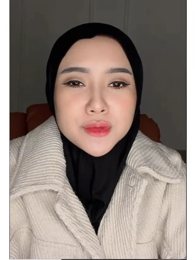 6 Potret Cita Citata Curhat Penyesalan Sering Suntik Putih, Kini Idap Autoimun