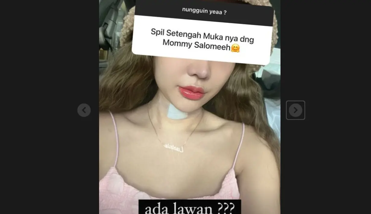 Lucinta Luna kembali memperlihatkan bagian hidung dan bibir, namun kini dari angle depan. (Foto: Instagram/ lucintaluna_manjalita)