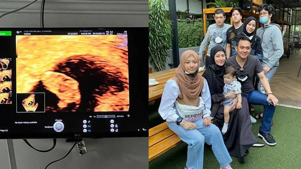 Alami Keguguran, Ini 6 Momen Kompak Lyra Virna Bersama Buah Hati
