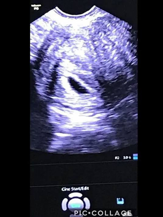 Dituliskan di unggahan fotonya bahwa Kalina begitu sedih dengan kepergian anaknya ini. Namun ia berusaha untuk ikhlas karena ia sadar bahwa sang pencipta lebih menyayangi malaikat kecilnya itu. (Instagram/kalinaocktaranny)