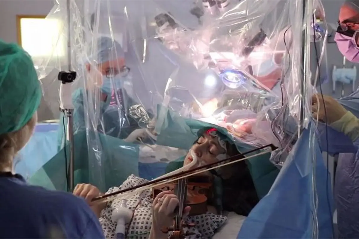 Pebiola Dagmar Turner bermain biola saat menjalani operasi pengangkatan tumor dari kepalanya.