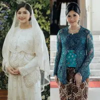 Tebak-tebakan jenis kelamin bayi Erina Gudono dari gayanya selama hamil.