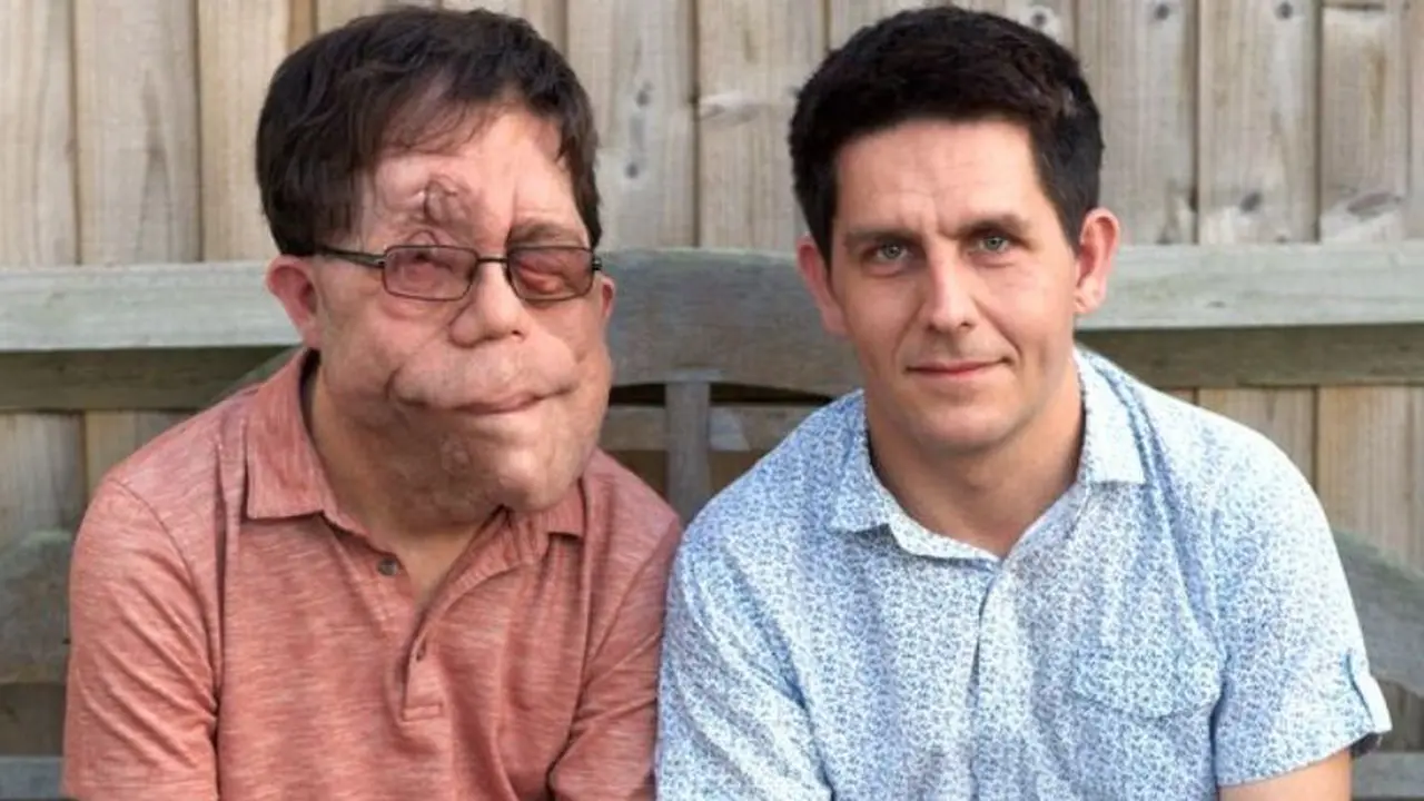 Adam dan Neil Pearson. Foto: Mirror