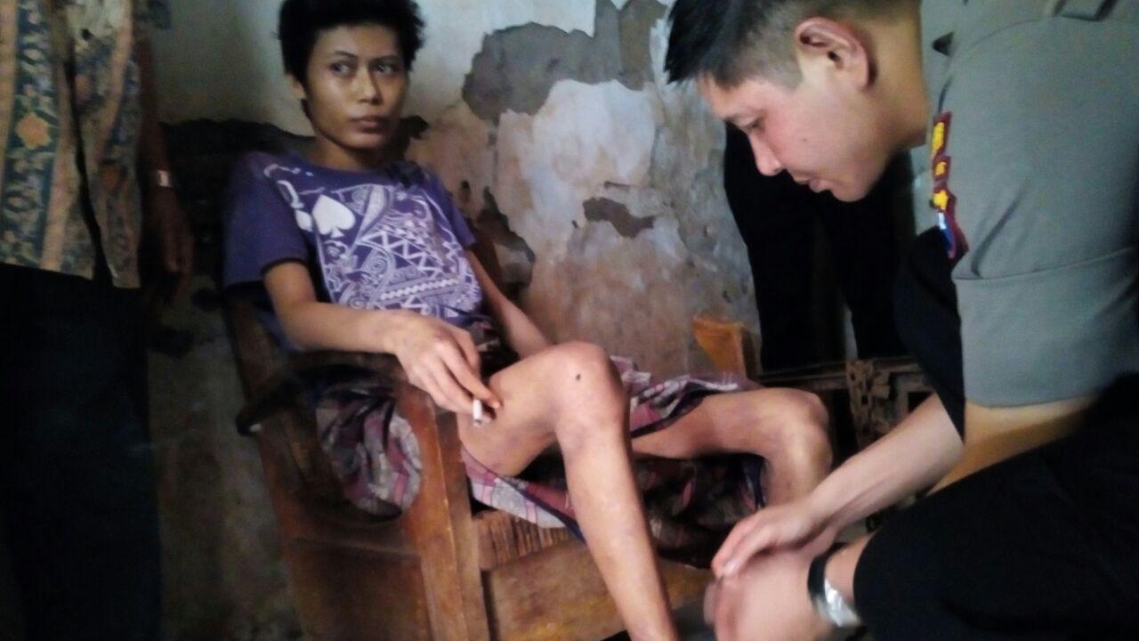 Hidup Terpasung, Pemuda Probolinggo Alami Kekurangan Gizi