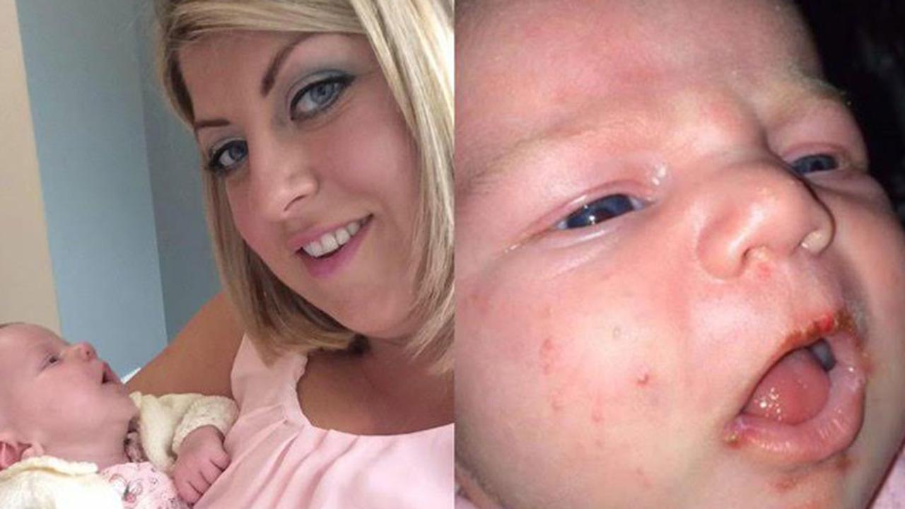 Hati-Hati! Jangan Biarkan Bayi Anda Dicium Sembarang Orang