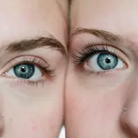 Apa saja penyebabnya dan bagaimana cara atasi kantung mata yang muncul? Simak selengkapnya berikut ini.